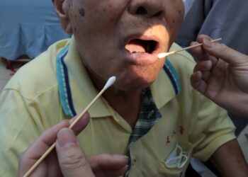 嚼檳榔超過40年 老翁戒檳10多年仍二度唇癌