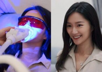 牙齒美白忽略「這一項」　效果打折大ＮＧ