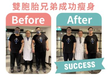胃繞道手術見成效　雙胞胎兄弟減重40公斤重拾健康